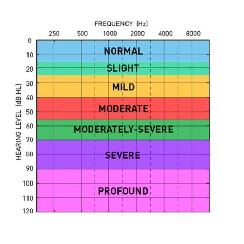 Advanced Hearing Testing chart